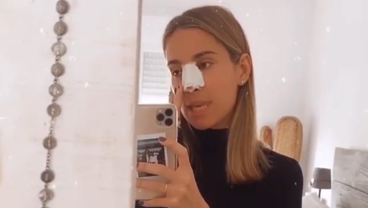 María Pombo tras su segunda operación de nariz/ Foto: Instagram