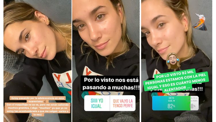 María Pombo confiesa su problema cutáneo durante la cuarentena | Foto: Instagram
