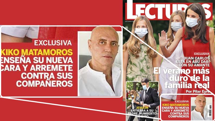 Kiko Matamoros presume de nuevo rostro desde el hospital en la revista Lecturas