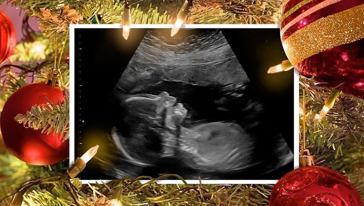 La ecografía con la que Meghan Trainor ha anunciado su embarazo / Instagram