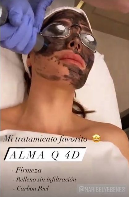 Pilar Rubio enseñando el tratamiento en su rostro/ Foto: Instagram