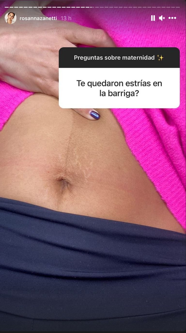 Rosanna Zanetti enseña las estrías que le han quedado después de sus dos embarazos/ Foto: Instagram