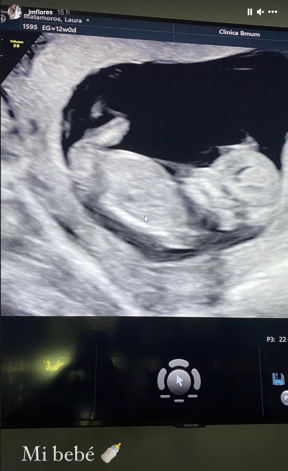 Laura Matamoros comparte una ecografía de su segundo bebé/ Foto: Instagram