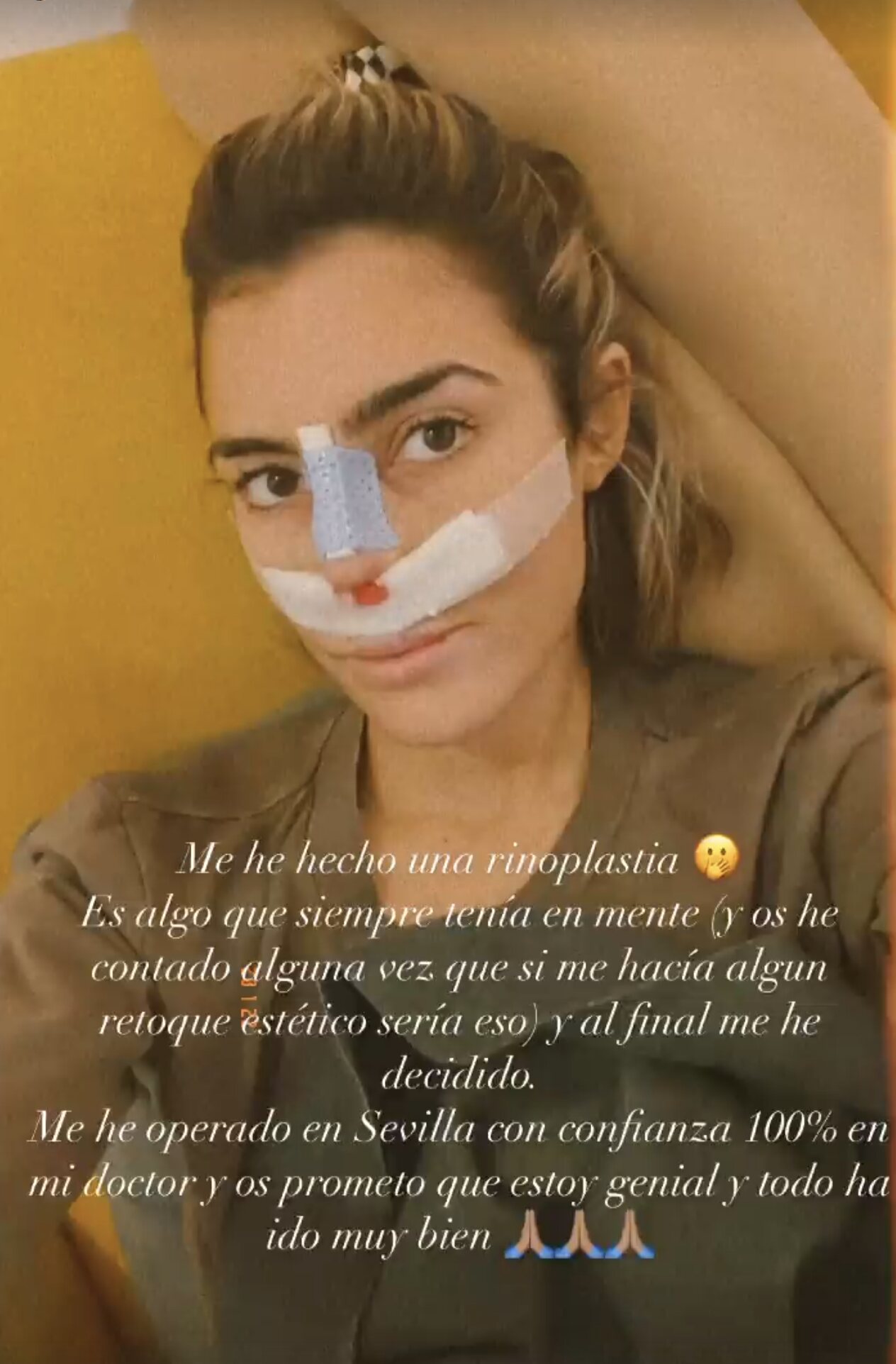 Anna Ferrer enseña su rostro tras la operación