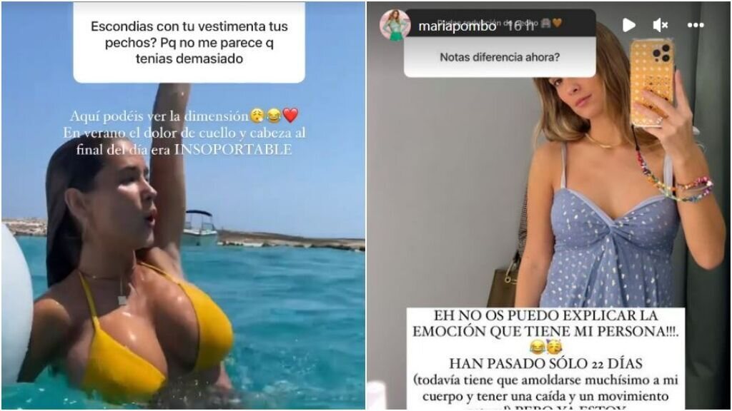 El antes y después del pecho de María Pombo/ Fotos. Instagram
