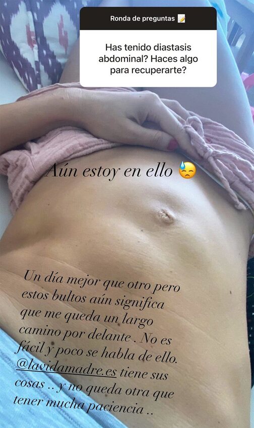Ariadne Artiles enseña su barriga tras el parto/ Foto: Instagram