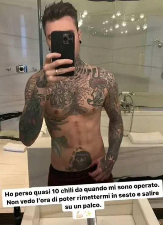 Fedez muestra su cuerpo tras su operación/ Foto: Instagram