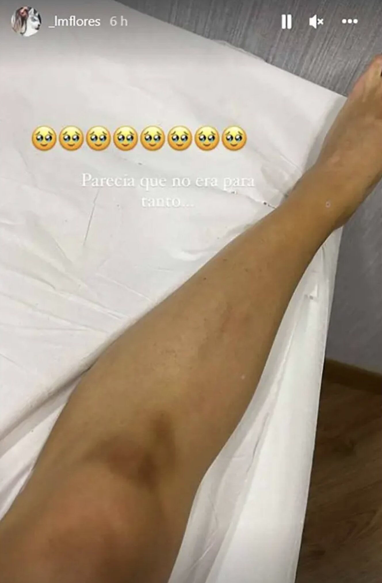 Laura Matamoros enseña su pierna tras la caída/ Foto: Instagram