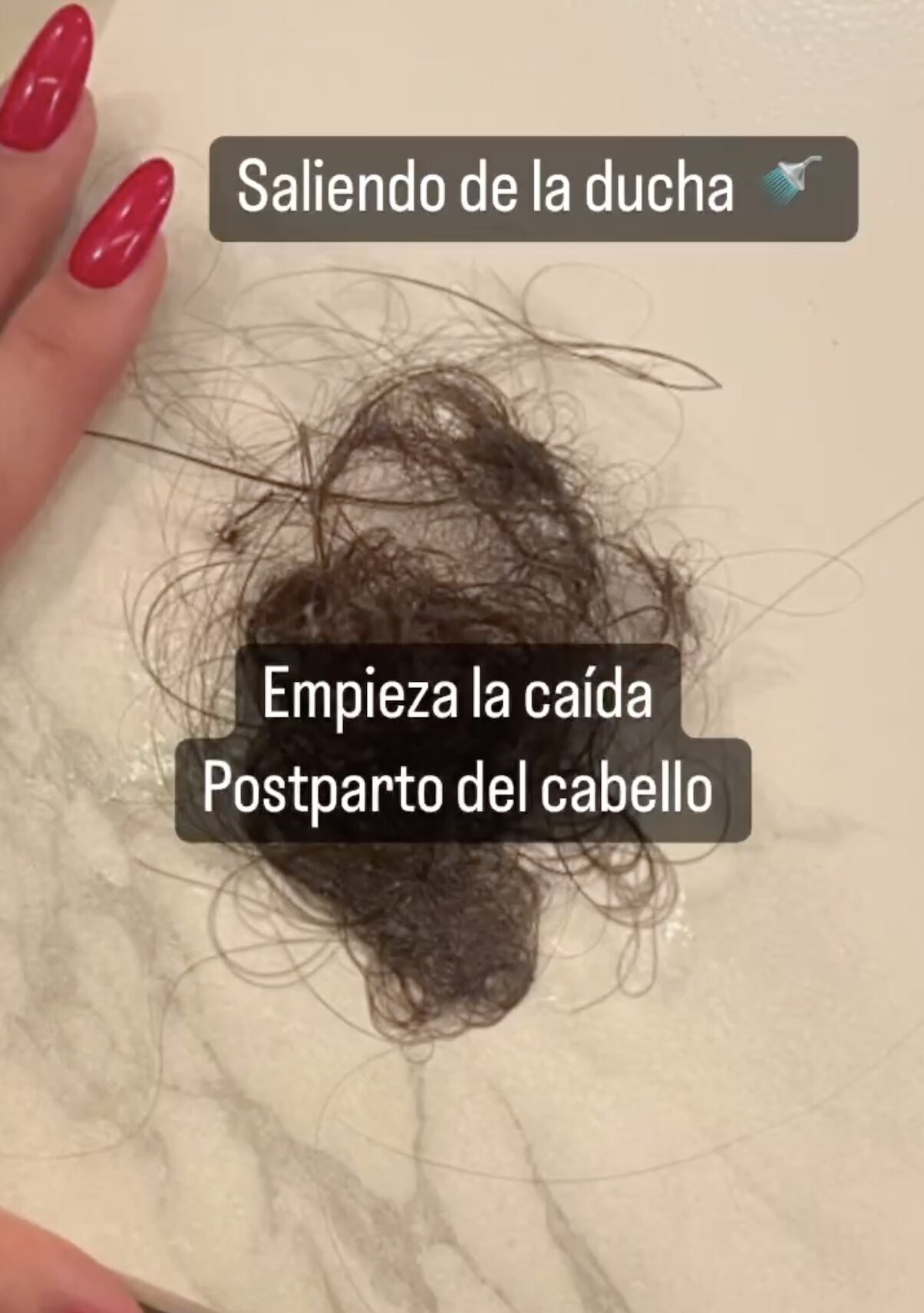 Carla Barber enseña el pelo que se le ha caído/ Foto: Instagram