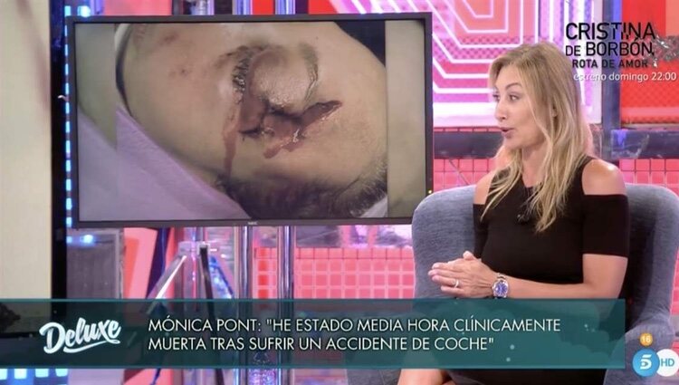 El accidente de Mónica Pont | Foto: telecinco.es