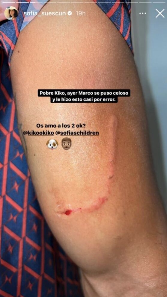 Kiko Jiménez también sufrió un incidente con el perro de su chica/ Foto: Instagram