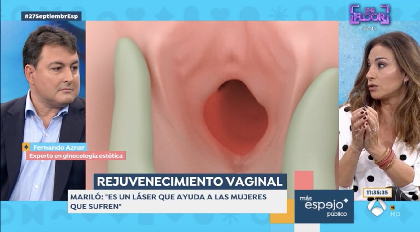 Mariló Montero se ha vuelto a someter a un rejuvenecimiento genital | Foto: Antena3.com