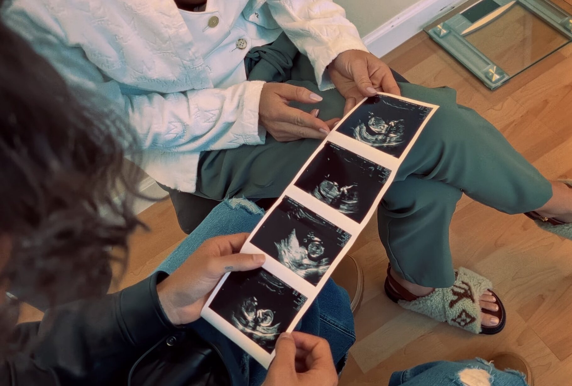 La ecografía del bebé de Maluma y Susan Gómez/ Foto: Youtube