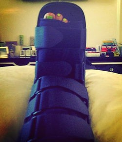 El pie lesionado de Kelly Osbourne