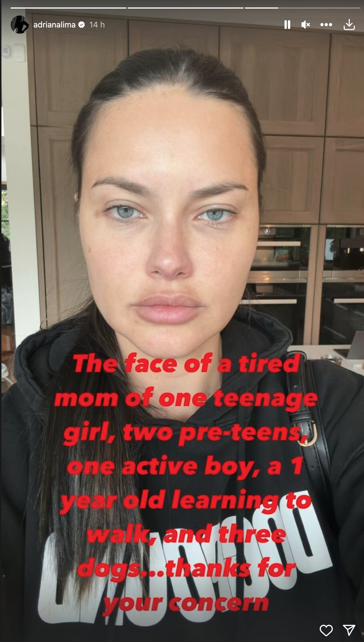 Adriana Lima responde a los comentarios sobre su rostro en su última aparición pública | Foto: Instagram