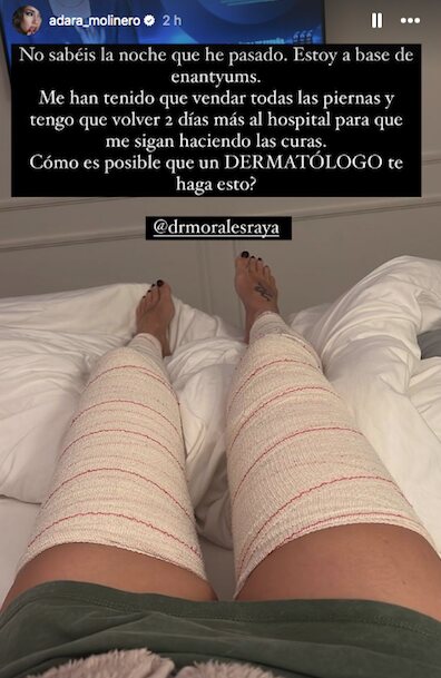 Adara Molinero enseña sus piernas vendadas/ Foto: Instagram