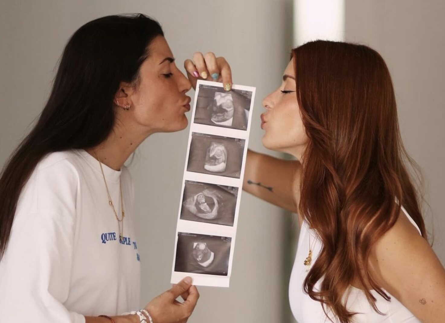 Dulceida y Alba Paul tras anunciar que van a ser madres/ Foto: Instagram