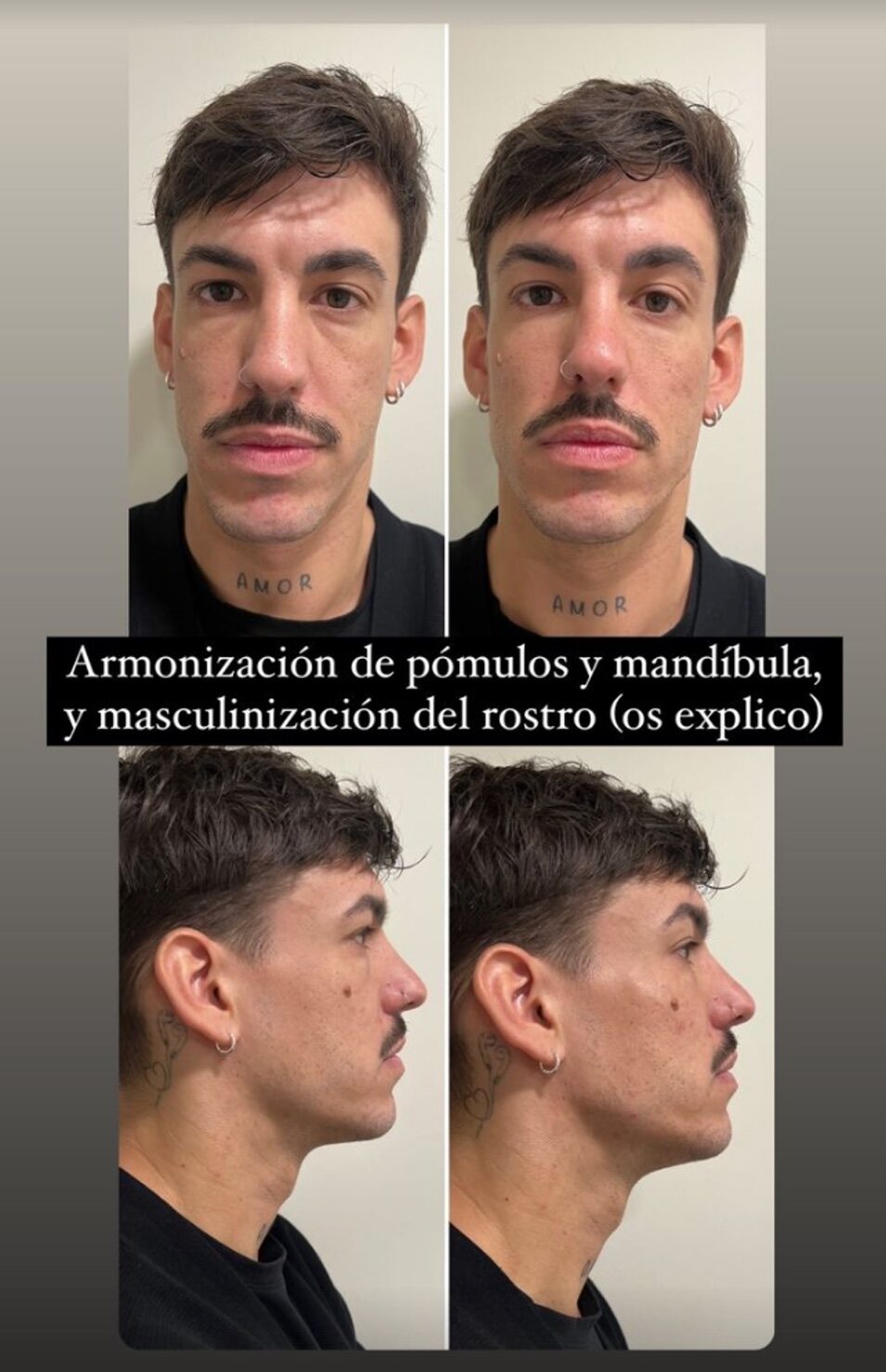 Cambio facial de Luitingo | Instagram