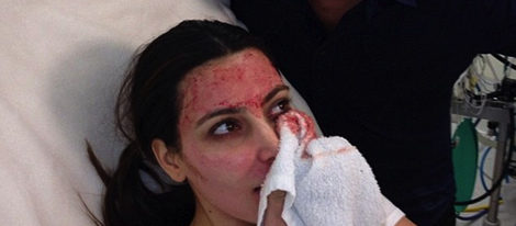 Kim Kardashian con su tratamiento de sangre / Foto:Twitter