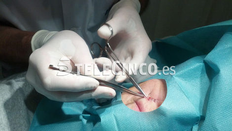 Mercedes Milá, operada de una mancha cancerígena
