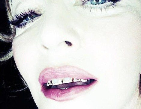 Madonna muestra sus fundas de oro y diamantes. Fuente: Instagram