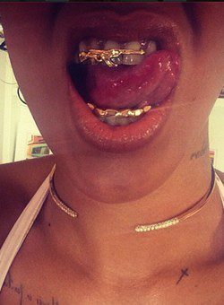 Rihanna con fundas de oro / Instagram