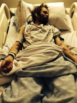 Deryck Whibley ingresado en el hospital | Web Oficial