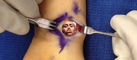 Divertido montaje de su lesión de muñeca hecho por la propia Miley Cyrus