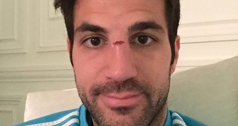 Fàbregas se rompió la nariz durante un partido con el Chelsea | Instagram 