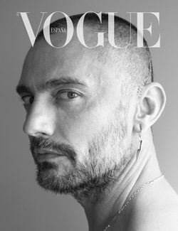 David Delfín posa tras su operación / Imagen: Vogue España