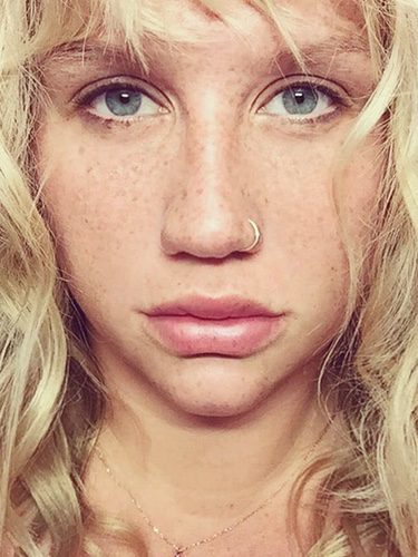 Con esta imagen Kesha se ha pronunciado en Instagram sobre la demanda