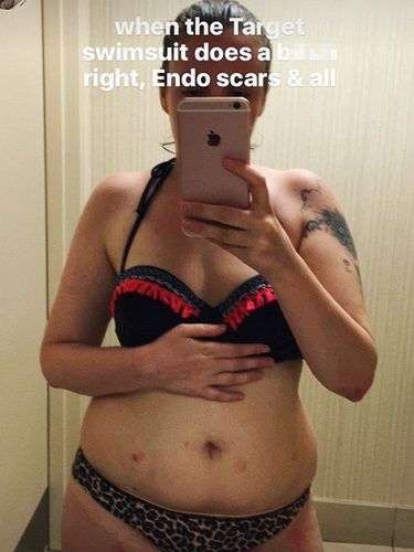 Lena Dunham en bikini / Foto: Snapchat
