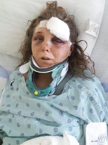 Carleigh Hager en el hospital tras la agresión