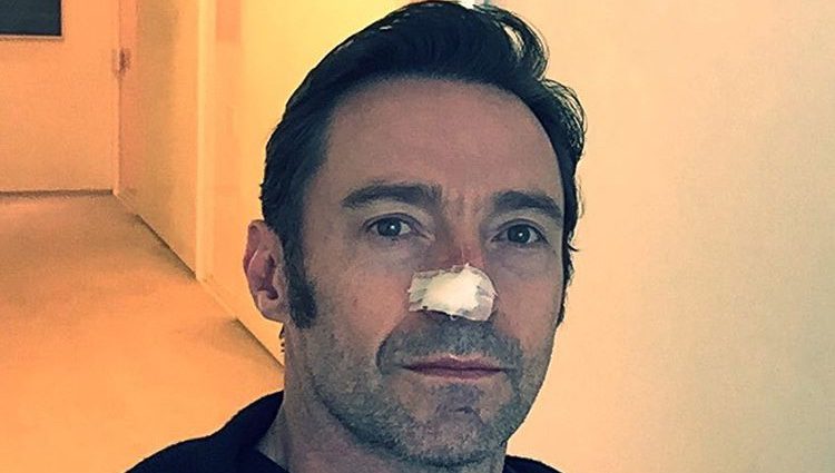Fotografía que el actor ha subido a su cuenta de Instagram tras su operación/ Fuente: Hugh Jackman