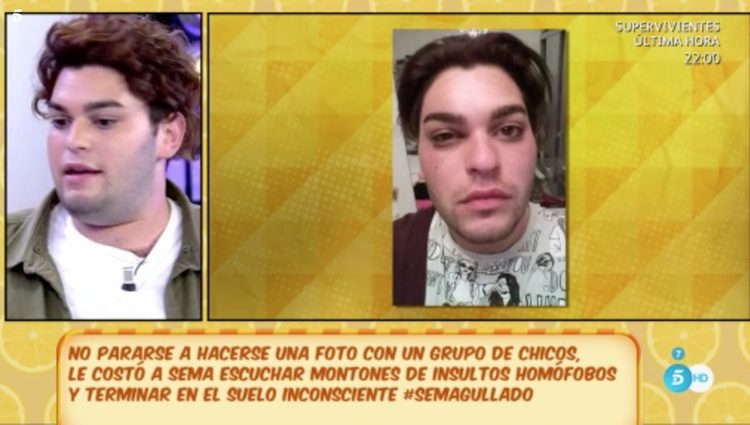 Sema mostrando las consecuencias de la agresión que recibió la pasada semana / Foto: Telecinco.es 