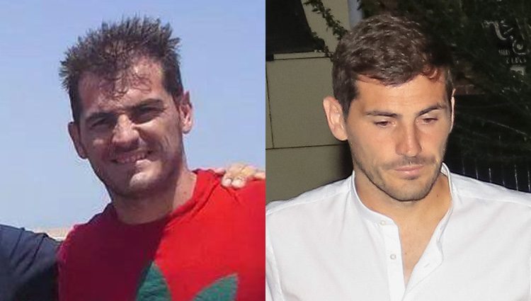 Iker Casillas con poco pelo y después de un tratamiento