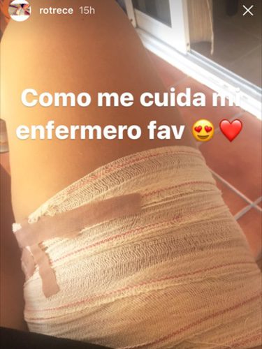 La pierna vendada de Rocío Flores / Instagram