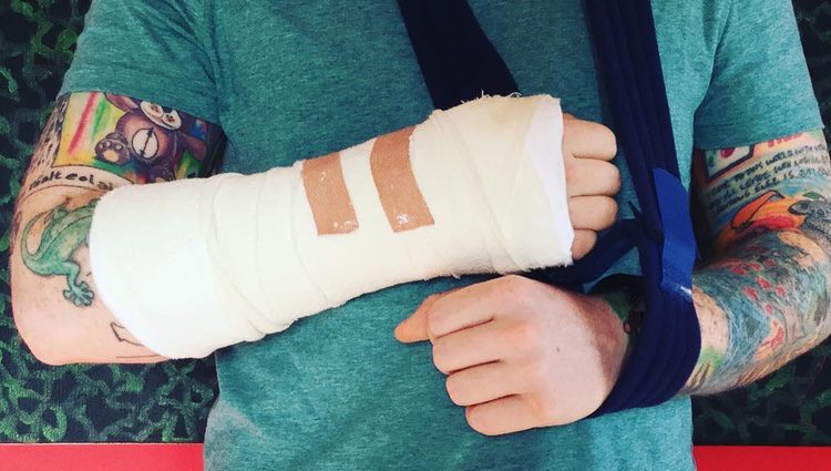Ed Sheeran muestra su brazo roto / Instagram