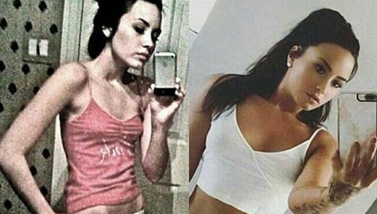 El antes y después de Demi Lovato. | Fuente: Instagram