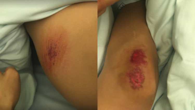 Mari Cielo muestra las heridas de su atropello / Facebook