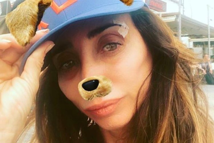 María Patiño, con puntos y cara de perrito/ Fuente: Instagram