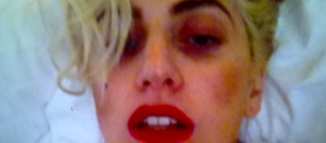Lady Gaga acaba uno de sus conciertos con un moratón en el ojo y publica la fotografía en Twitter