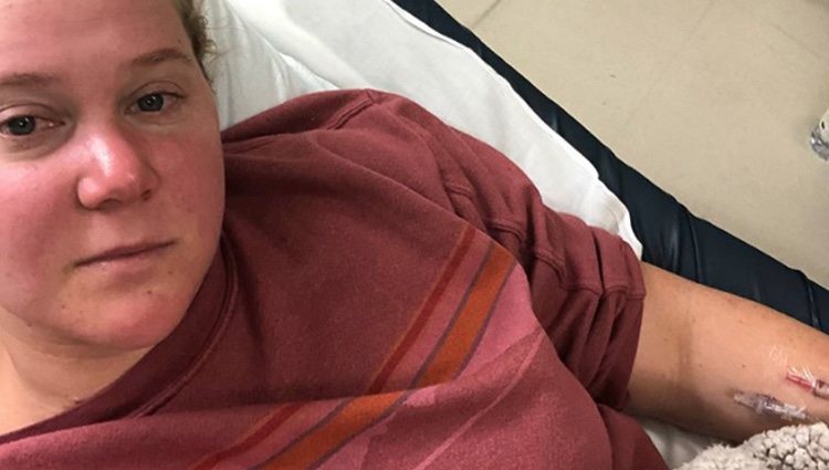 Amy Schumer hospitalizada por su infección renal | Instagram