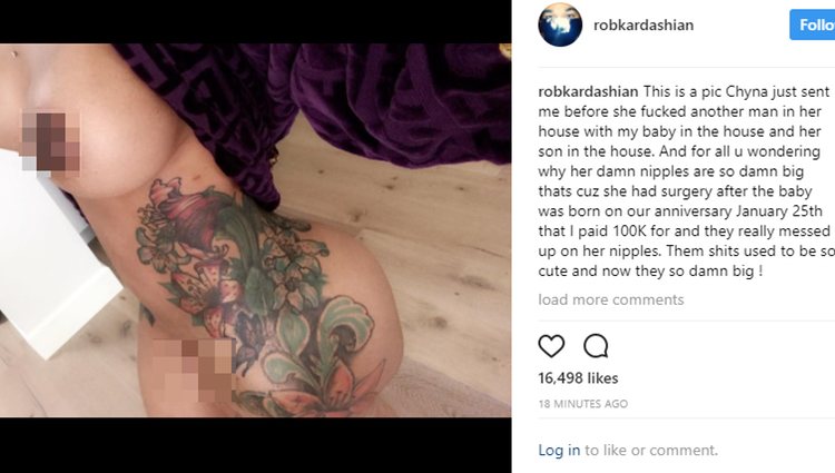 Una de las fotos íntimas que Rob publicó en su Instagram / Fuente: Instagram