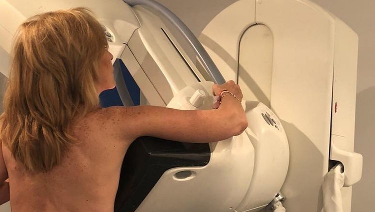 Rosa Benito haciéndose una mamografía/ Fuente: Instagram
