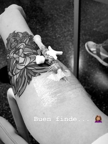 La imagen del brazo de Laura Matamoros con una vía/ Foto: Instagram