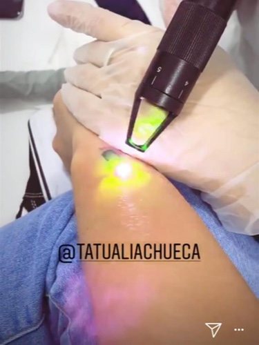 Anabel Pantoja dice adiós a su tatuaje|Foto:Instagram