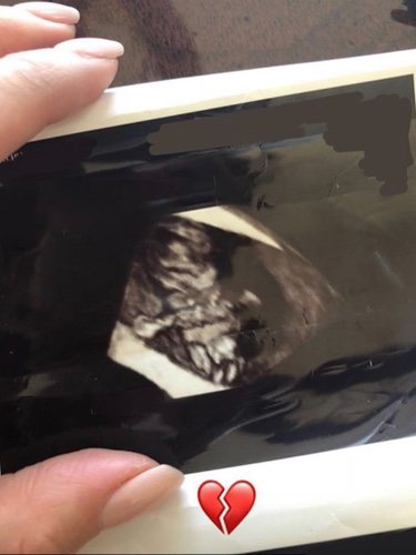 Imagen en la que Shay Mitchell confiesa que sufrió un aborto | Foto: Instagram