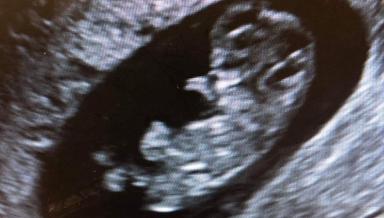 Foto del bebé que esperan Jenson Button y Brittny Ward publicada en Instagram por ambos