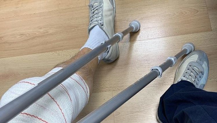 La pierna izquierda de Santiago Segura tras la operación Foto: Instagram Santiago Segura